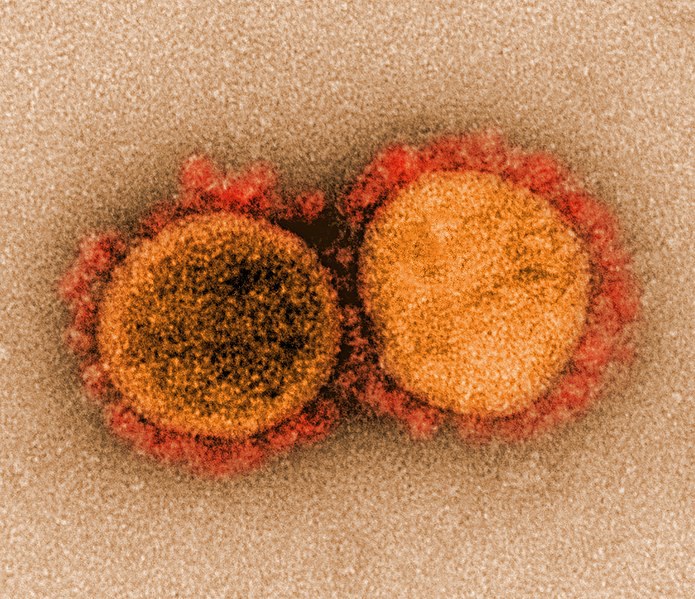 [Podcast] Update Coronavirus 02.04.2020